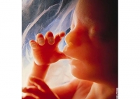 Hạ viện Hoa kỳ thông qua luật cấm phá thai hơn 20 tuần tuổi
